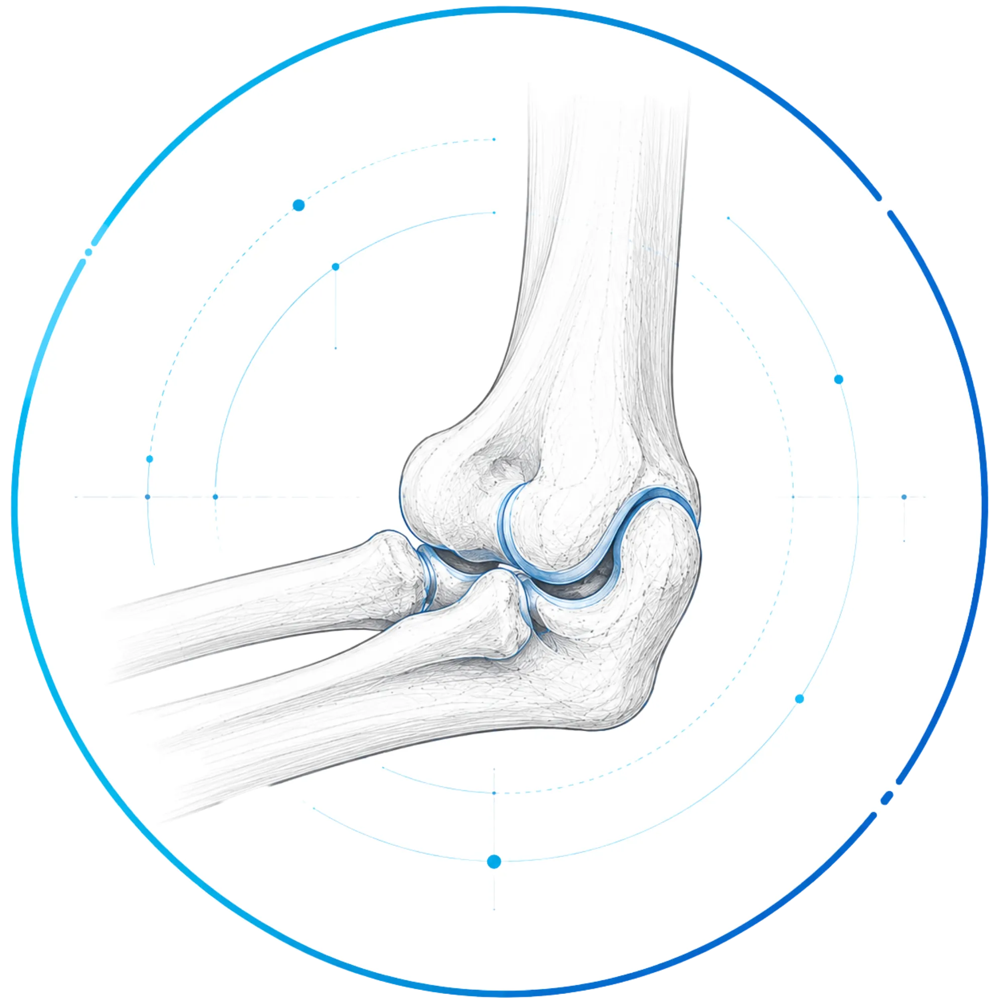 Elbow Surgery