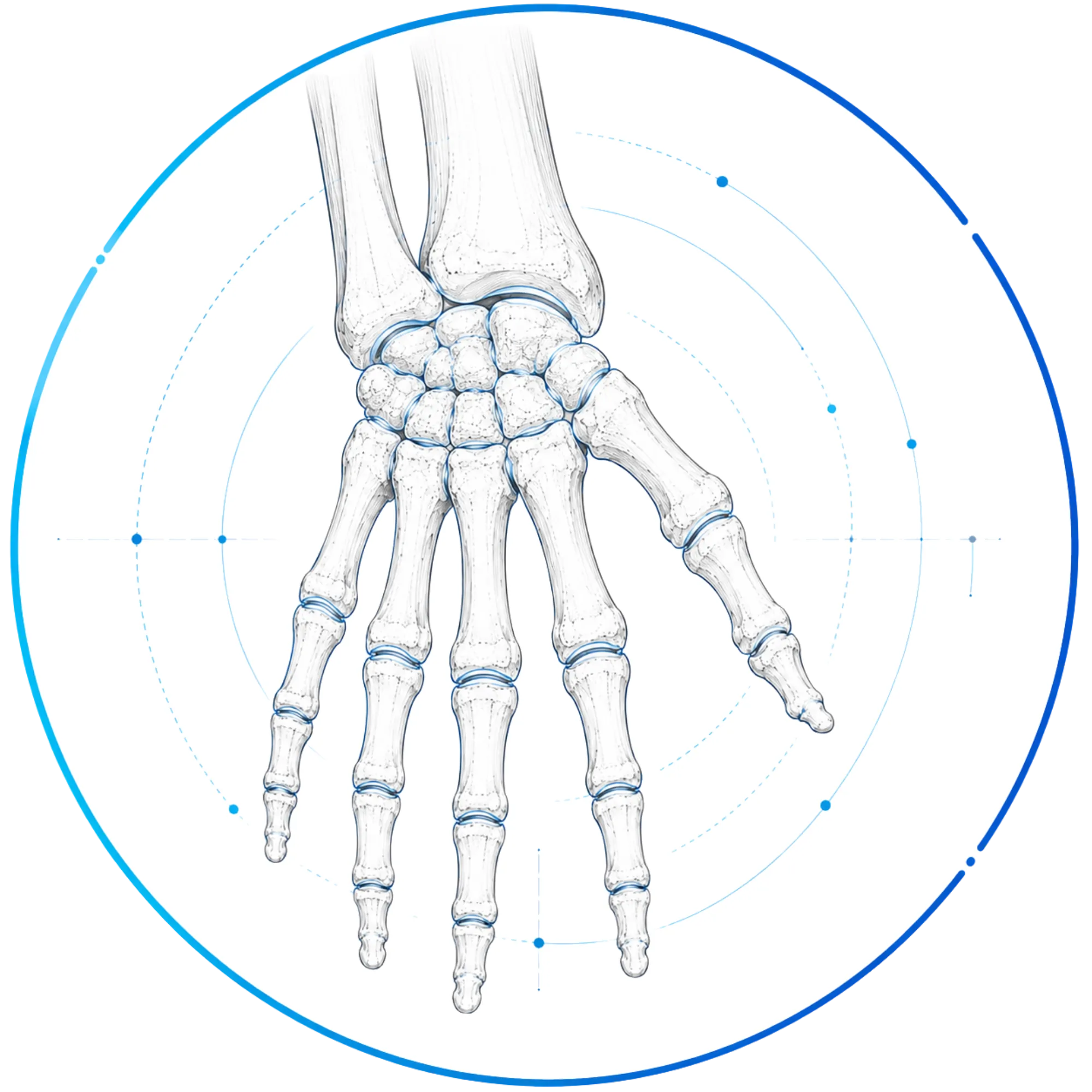Wrist Surgery